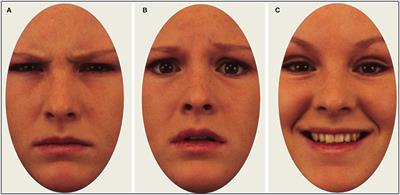 Restricted Visual Scanpaths During Emotion Recognition in Childhood Social Anxiety Disorder